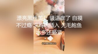 OnlyFan 美丽的白兔 (2)